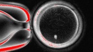 Researchers turn human skin cells into eggs