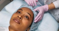 Study finds Botox patients receive ‘alarming’ differences in quality of care