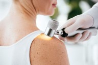 Recurrence-Free Survival Longer With Nivolumab Than Ipilimumab in Melanoma