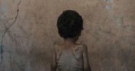 Nearly 55,000 children in Gaza under age 5 may be acutely malnourished, a new UN study finds