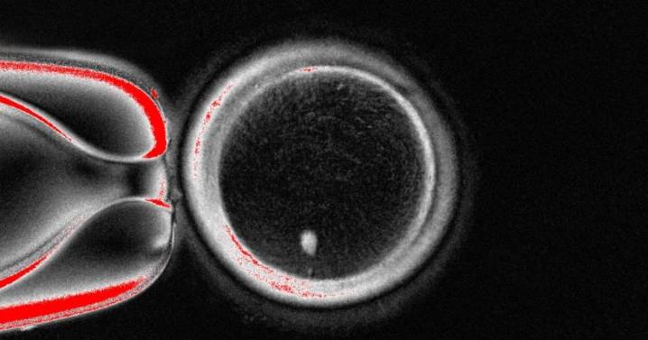 Hacer óvulos con células de la piel: el primer paso para crear embriones a través de la piel