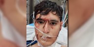 Tucson man brutally stabbed while on Greyhound bus