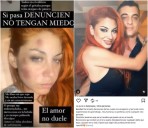 Valeria Gastaldi reveló terribles maltratos que sufrió Lourdes del ex novio: “Le fisuró una costilla”