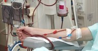 Hasta 68.400 pacientes en diálisis durante el 2024, casi mil más