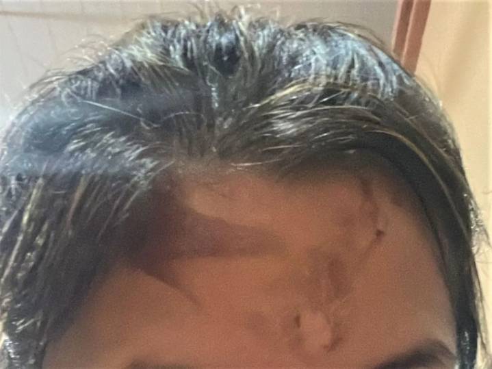"Discutimos y me tiró agua caliente", grave denuncia contra un oficial de policía obereño