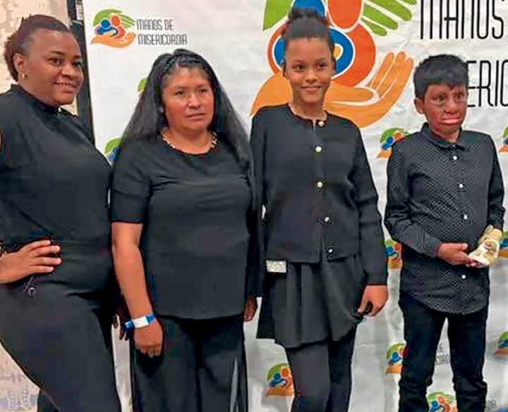 “Manos de Misericordia”, ayudando a niños quemados