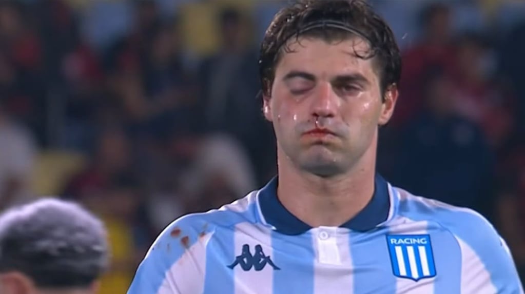 El futbolista de Racing Santiago Sosa sufrió una fractura en la cara tras el golpe que le dio Marcos Rojo