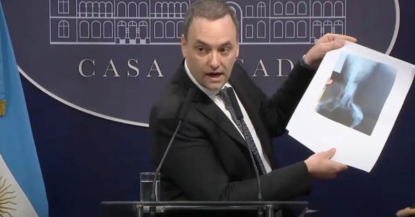 Cambia el Certificado Único de Discapacidad: cuándo hay que renovarlo y qué requisitos se deben cumplir