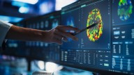 Cambios en la dieta pueden retrasar el deterioro cognitivo