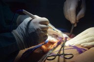 Doctors perform rare ‘double stomach’ surgery in Srinagar