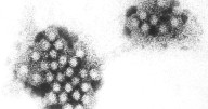 Oceania Insignia: Luxury cruise beset by norovirus