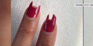 Rat chewed off part of woman’s fingernails in Las Vegas Valley, pest control GM says