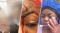 17-year-old speaks out after she was beaten in Miami Northwestern bathroom – NBC 6 South Florida