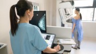 Cáncer de mama: preocupa el aumento de casos y la baja en la edad de las pacientes