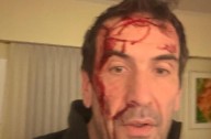 Violento asalto al candidato de LLA, Pablo Cervi: «Neuquén zona liberada. El 101 no funciona»