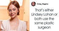 “Another Victim”: Emma Stone’s Louis Vuitton Photos Spark Frenzy Of Plastic Surgery Speculation