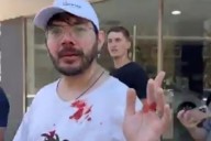 Santa Fe: libertario gritó "la casta tiene miedo" y le rompieron la cara