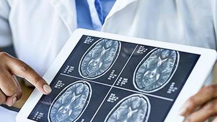 Can a stent in the brain stop a stroke before it happens?