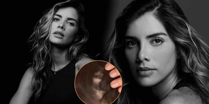 Korina Rivadeneira revela el drama de salud que enfrenta: “Hace cinco meses empezó esta tortura”
