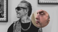 Tito Fuentes de ‘Molotov’ comparte impactante foto de su reconstrucción de nariz por las drogas