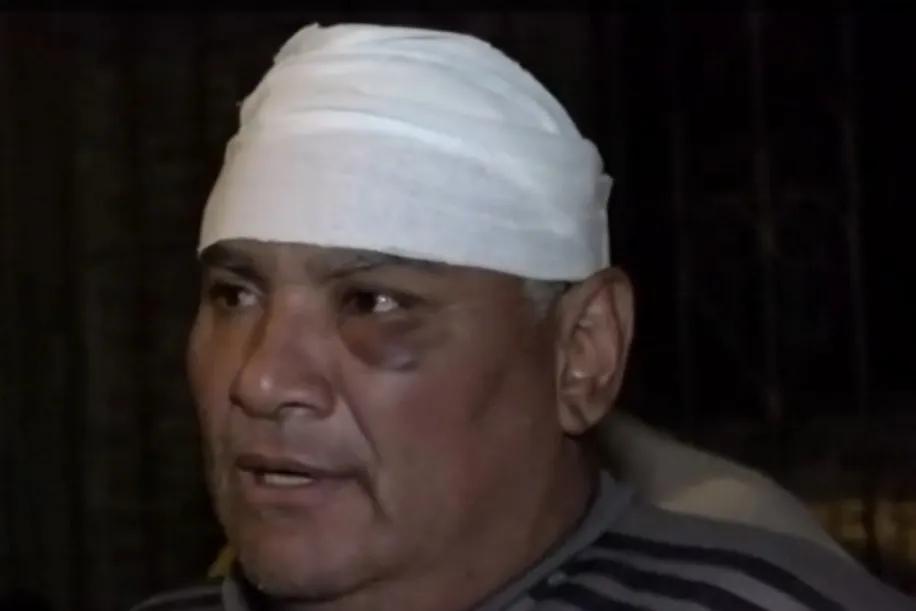 Vecinos denuncian "aguantadero y descontrol" en B° Solidaridad, un vecino recibió un palazo