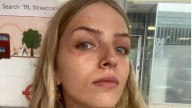 Una joven de 22 años fue a un bar con amigos y días después le diagnosticaron una “enfermedad victoriana”