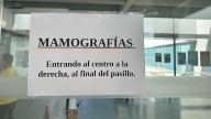 La asociación AMAMA computa la muerte de "varias mujeres" por retrasos en el cribado