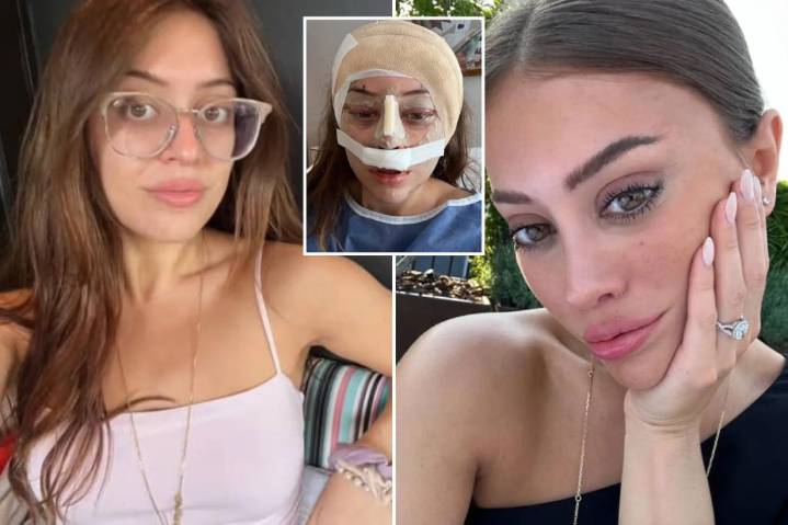 Exclusive | Women under 30 opting for major plastic surgery, alarming experts
