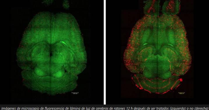 Científicos logran revertir el alzhéimer en ratones mediante nanopartículas