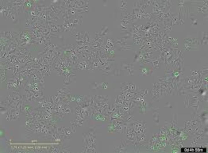 Descubren un mecanismo bacteriano que podría destruir células tumorales