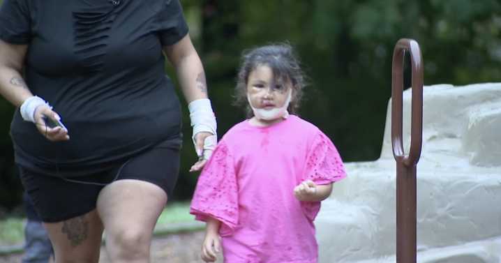 Mom and 4-year-old daughter brutally attacked by dog in Mentor
