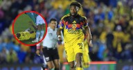 ¡Otra baja! Allan Saint-Maximin sufre dolorosa lesión tras una patada en el América vs Santos (VIDEO)