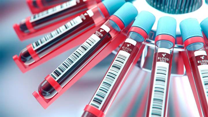 Un análisis de sangre podría permitir la detección temprana de la ELA