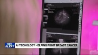 How AI is helping detect breast cancer