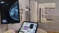Casi 10.500 altoaragonesas han participado en el cribado de cáncer de mama en Aragón