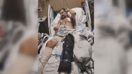 Man survives being dragged by car in St. Louis, seeks recovery aid