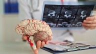 Hábitos que protegen el cerebro y previenen enfermedades neurológicas