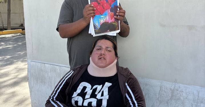 Pide justicia mujer lesionada en un circo  de Tijuana
