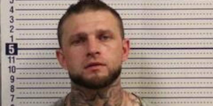Man accused of beating victim with ‘metal knuckles’