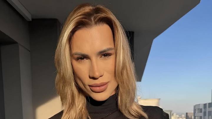 Fallece influencer tras someterse a cirugía conocida como "ojos de zorro" 7 de octubre de 2025 | Espectáculos En septiembre pasado el influencer informó haber lidiado con complicaciones por la operaci