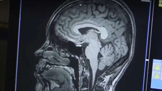 Universities team up on brain and behavioral research
