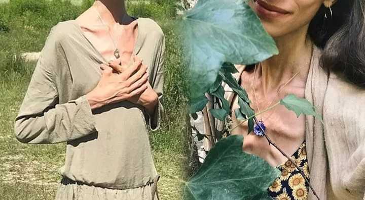 Muere QUERIDA influencer por DESNUTRICIÓN tras seguir dieta estricta: Pesaba 22 kilos y su última foto dejó en SHOCK