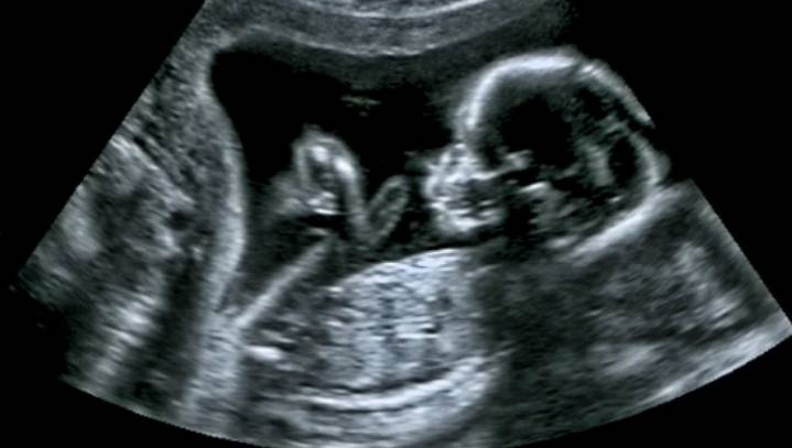 Close One: This Baby Was Almost Born Into Poverty But His Mother Killed Him In The Nick Of Time