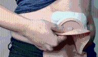 Pacientes con ostomía: el reto de aceptar las consecuencias del cáncer