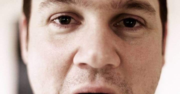 Dentist sheds light on condition turning tongues black and hairy