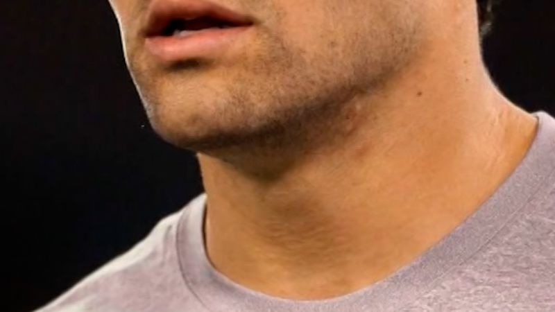 Mark Sanchez facing felony charge in Indianapolis altercation