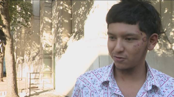 Man punched by Austin police officer on 6th Street speaks out