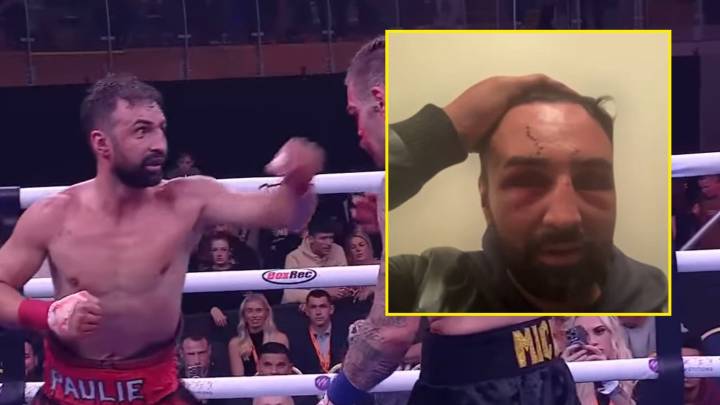 'Like something stabbed me' - Paulie Malignaggi shows off gruesome injuries from bare
