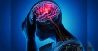 79% rise in brain stroke cases in state in 2024
