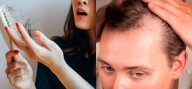 Estas bebidas podrían acelerar la pérdida del cabello y el encanecimiento prematuro